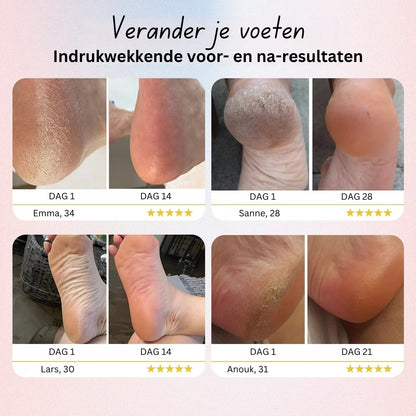 Elektrische Voetvijl